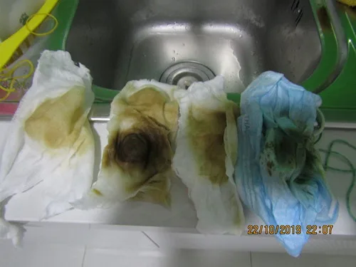 [Máy lọc nước #1] Dân chung cư ở TP.HCM hoang mang vì nước có màu, gây ghẻ ngứa 2